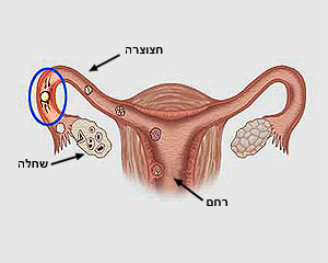 ההפריה מתרחשת בחצוצרה